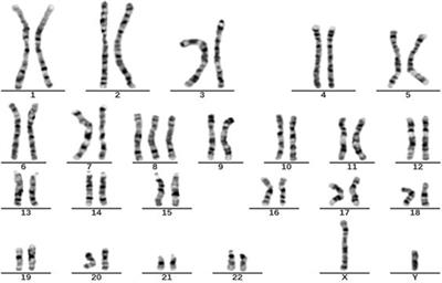 Trisomy 8 presentation by inflammatory manifestations and its response to thalidomide: two case reports and narrative review